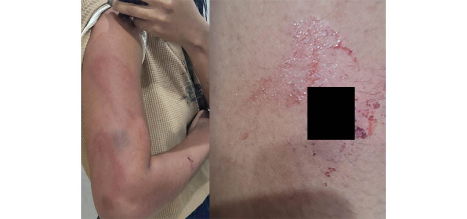 Pai é preso acusado de dar cintadas na filha ao discordar da criação dada ao neto