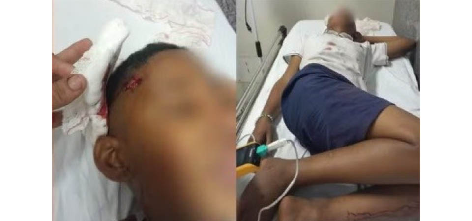 Jovem é morto a facadas e pauladas, e tem faca cravada nas costas