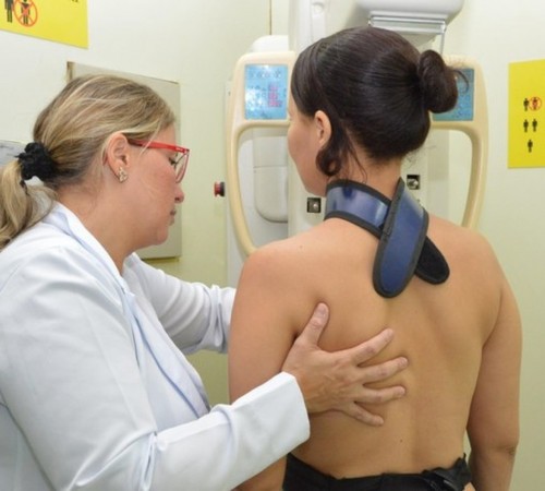 SUS inclui medicamento de alto custo para pacientes em metástase do câncer de mama