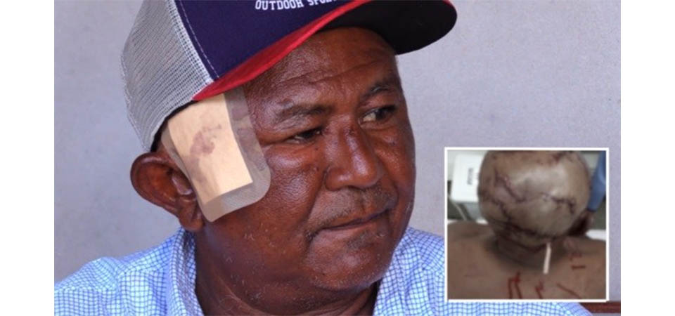 Homem que amarrou e matou onças a pauladas e golpes de facão é preso