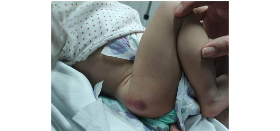 Mulher de 19 anos é presa por maus-tratos contra filha de um ano e passar maquiagem para esconder lesões