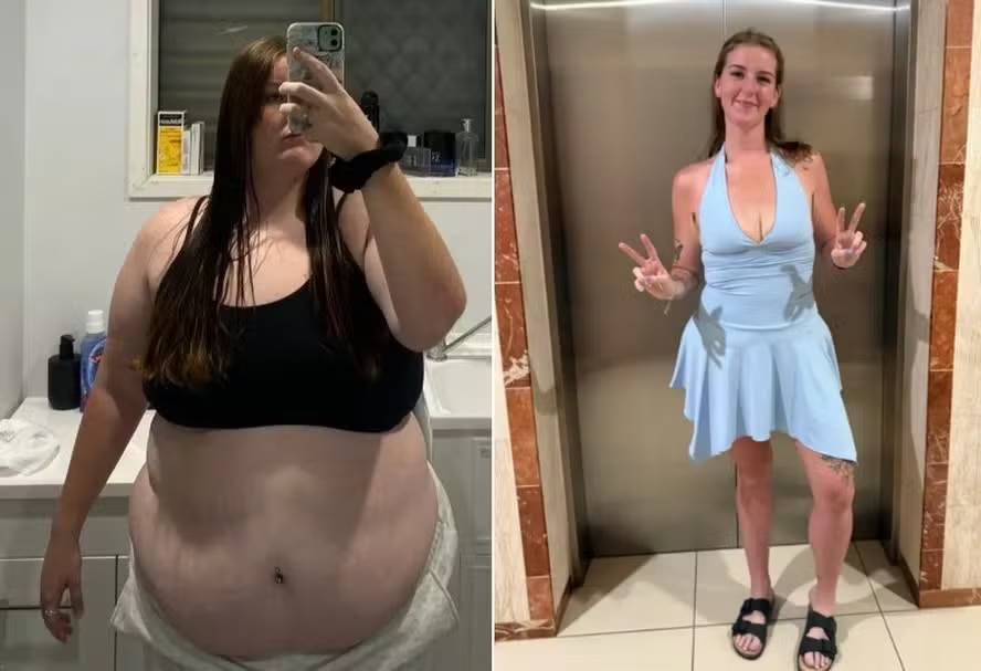 Jovem emagrece 63 quilos sem caneta ou cirurgia