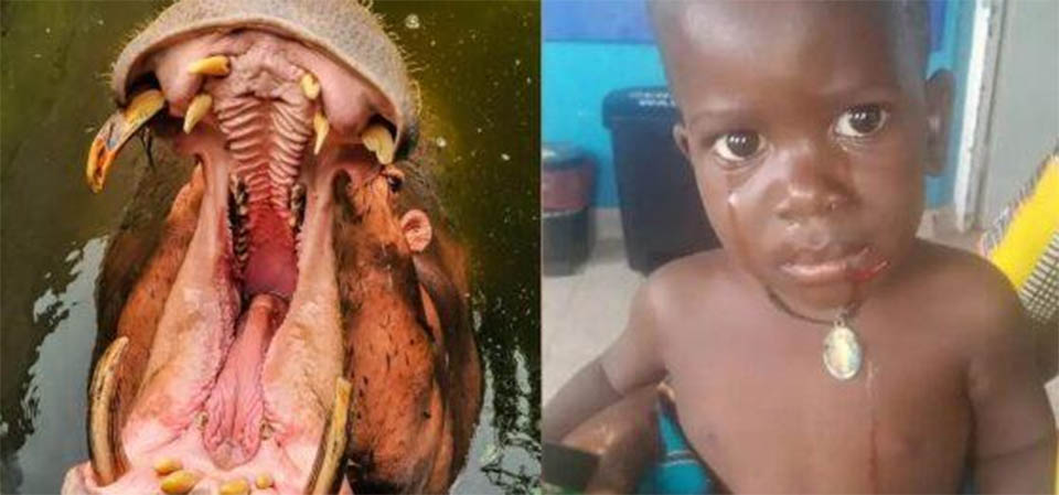 Hipopótamo engole menino de 2 anos pela cabeça até metade de seu corpo e o “cospe” vivo