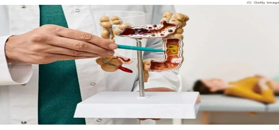 Grão popular ajuda a regular o intestino e apoia a saúde dos rins