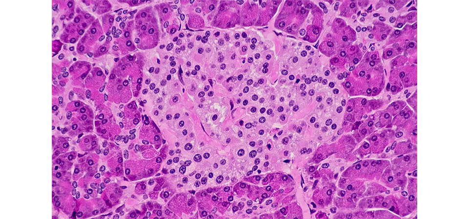 Anvisa aprova o primeiro remédio para diabetes tipo 1 do Brasil