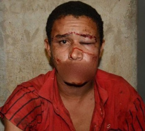 Moradora espanca ‘tarado’ que invadiu casa e tentou estuprá-la