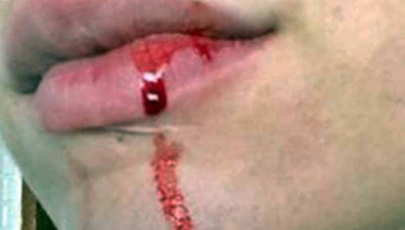 Mulher morde órgão sexual do parceiro em hotel, causa lesão e acaba presa em flagrante