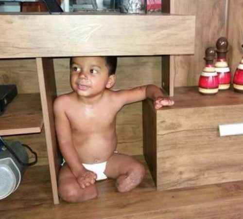 Mãe recebe doações para comprar próteses para filho que teve pernas amputadas após meningite em MT